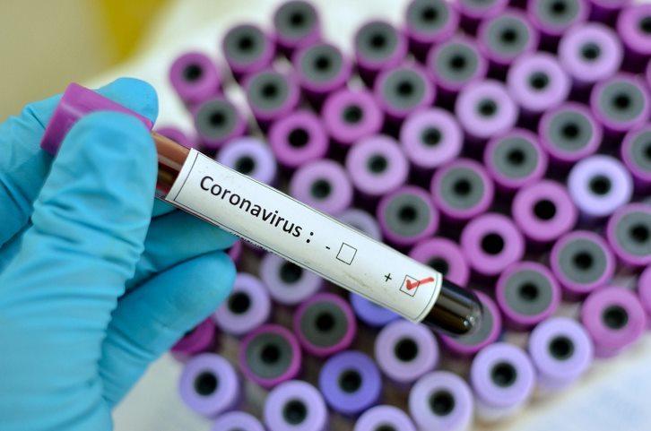 Analiză pozitivă de coronavirus